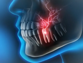Tooth Desensitization