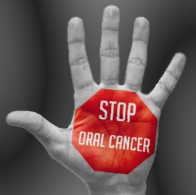 Oral Cancer Screening
