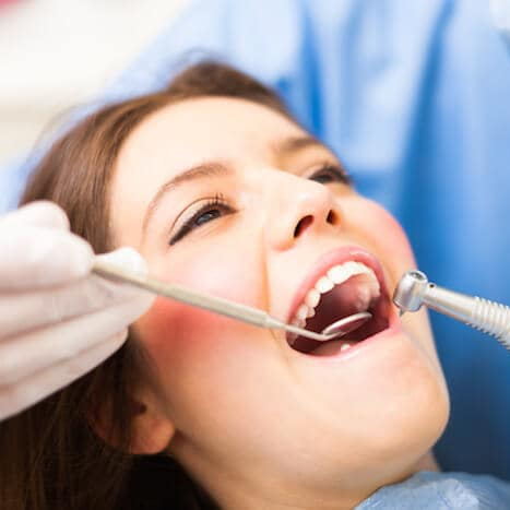Professional Teeth Cleaning